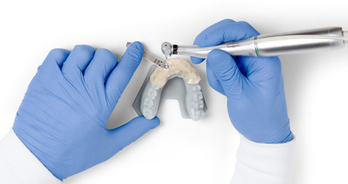 正畸牙套：牙科3D打印案例